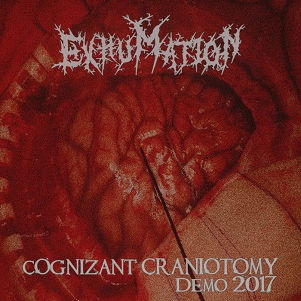 Exhumation (UK) : Cognizant Craniotomy: Demo 2017